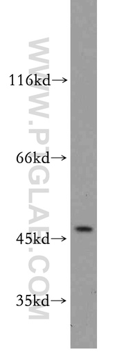 [11936-1-AP-150UL] Beta Sarcoglycan Polyclonal antibody