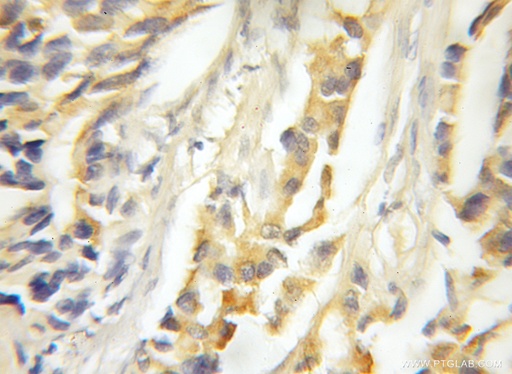 [11937-1-AP-150UL] MAPKSP1 Polyclonal antibody