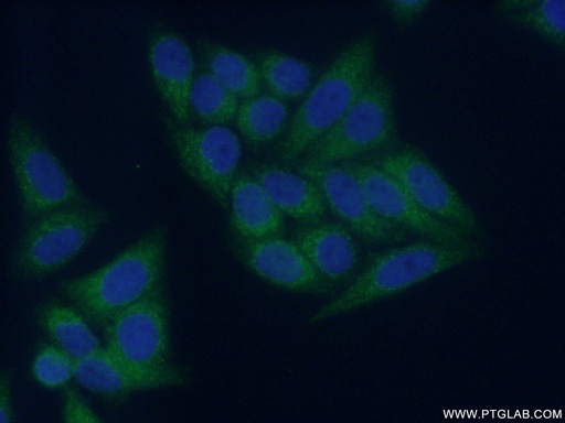 [11938-1-AP-150UL] COMMD1 Polyclonal antibody