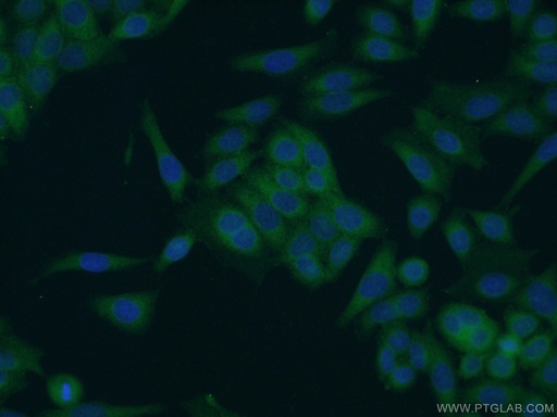 [11939-1-AP-20UL] SCHIP1 Polyclonal antibody