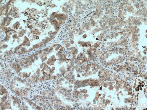 [11941-2-AP-150UL] GAS2 Polyclonal antibody