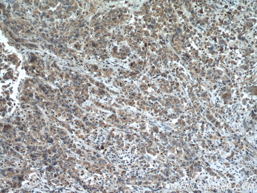 [11944-1-AP-150UL] STEAP4 Polyclonal antibody
