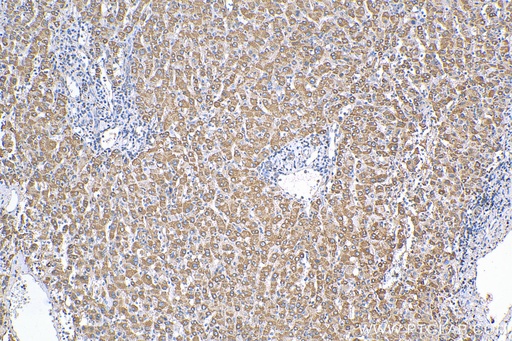 [11945-1-AP-20UL] ST7 Polyclonal antibody