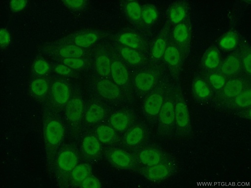 [11946-1-AP-20UL] ATF1 Polyclonal antibody
