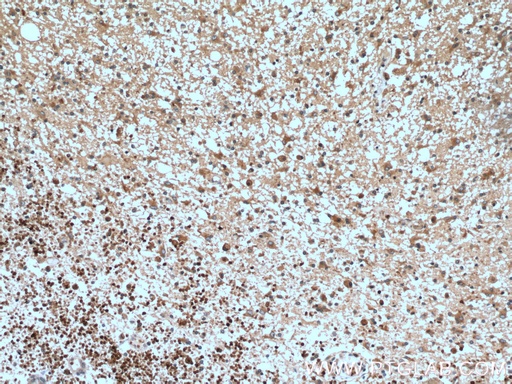 [11947-1-AP-150UL] RAB5A Polyclonal antibody