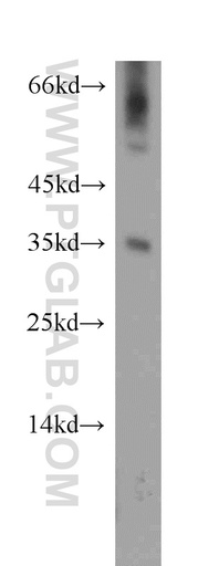 [11948-1-AP-150UL] DOK5 Polyclonal antibody