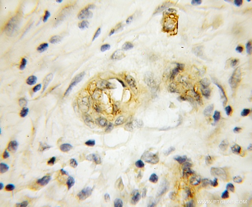 [11949-1-AP-20UL] RHCG Polyclonal antibody