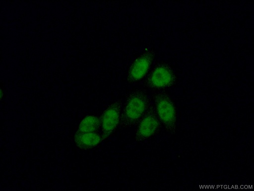 [11950-1-AP-20UL] CBP20 Polyclonal antibody