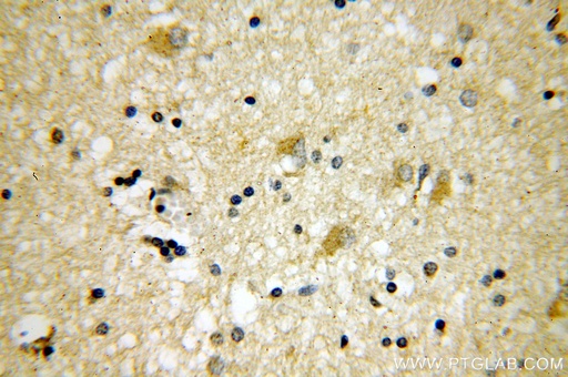 [11951-1-AP-20UL] PSTPIP1 Polyclonal antibody