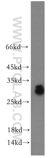 [11952-1-AP-20UL] ASB9 Polyclonal antibody