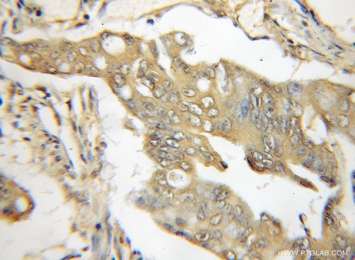 [11953-1-AP-150UL] TRIM6 Polyclonal antibody