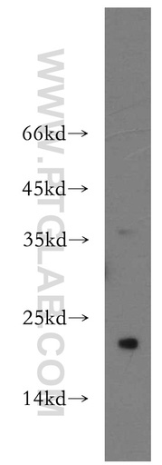 [11957-1-AP-150UL] SPANXC Polyclonal antibody
