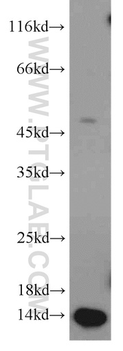 [11958-1-AP-20UL] PCBD2 Polyclonal antibody