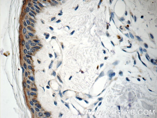 [11959-1-AP-20UL] SPRR1B Polyclonal antibody