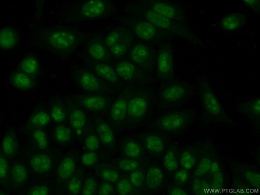 [11960-1-AP-20UL] NPM3 Polyclonal antibody