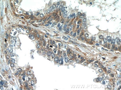 [11961-1-AP-20UL] PAGE2 Polyclonal antibody
