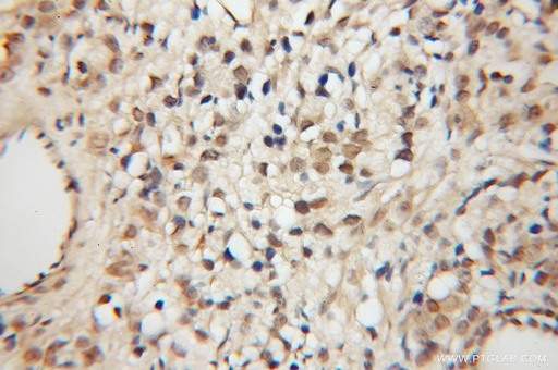 [11962-1-AP-150UL] MCPH/BRIT1 Polyclonal antibody