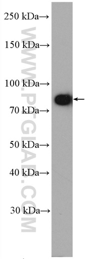 [11963-1-AP-20UL] DTX3L Polyclonal antibody