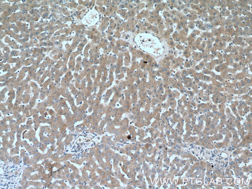 [11964-1-AP-150UL] ANGPTL3 Polyclonal antibody