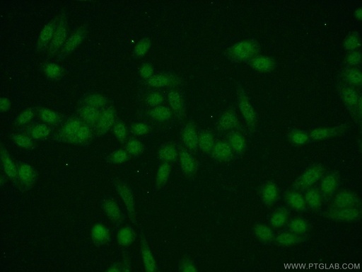 [11965-1-AP-150UL] EMG1 Polyclonal antibody