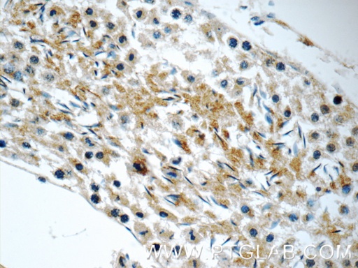 [11966-1-AP-150UL] FXYD4 Polyclonal antibody