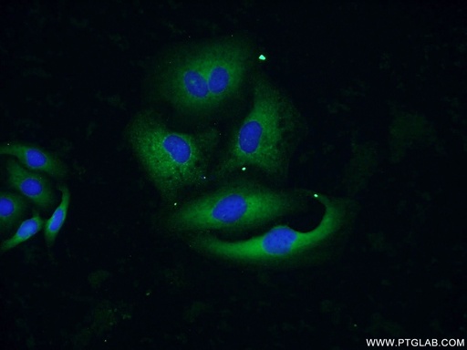 [11967-1-AP-20UL] AGR3 Polyclonal antibody