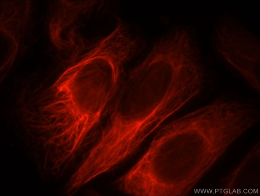 [11969-1-AP-20UL] PPP1R2P9 Polyclonal antibody