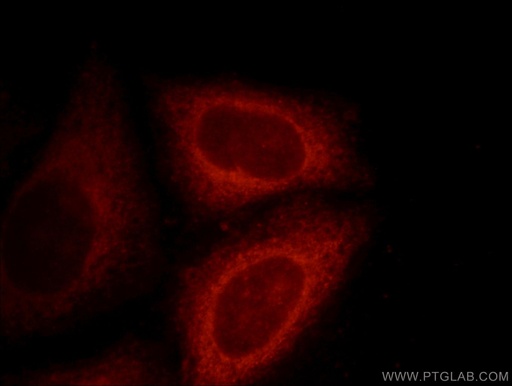 [11971-1-AP-20UL] DNAJC2/MPP11 Polyclonal antibody