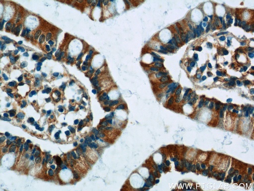 [11974-1-AP-150UL] FICD Polyclonal antibody