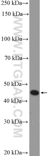 [11976-1-AP-150UL] P2RY12 Polyclonal antibody