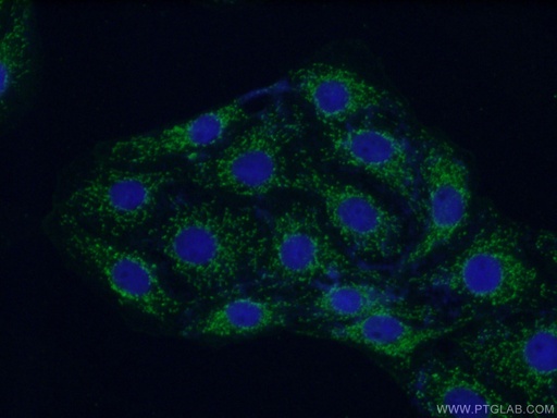 [11978-2-AP-20UL] GNB4 Polyclonal antibody