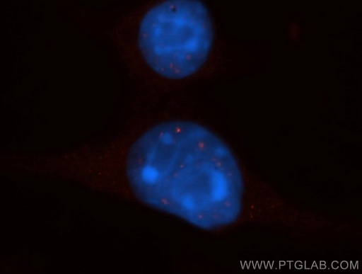 [11979-1-AP-150UL] EXOSC8 Polyclonal antibody