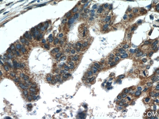 [11981-1-AP-150UL] TMED2 Polyclonal antibody