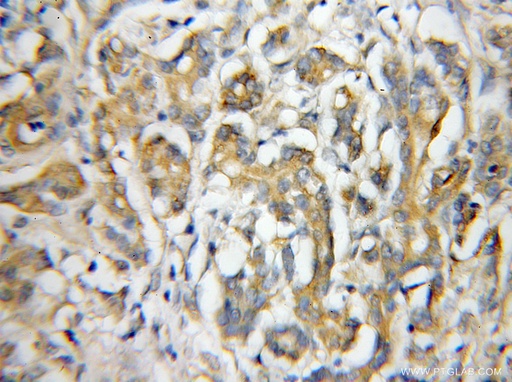 [11984-1-AP-150UL] IL-17RE Polyclonal antibody