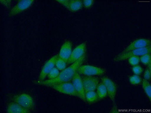 [11986-1-AP-150UL] PRTFDC1 Polyclonal antibody