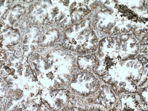 [11989-1-AP-150UL] CD147 Polyclonal antibody