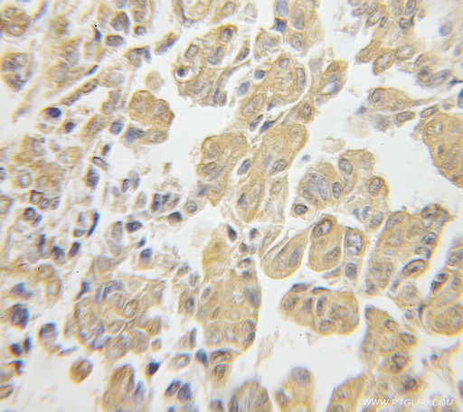 [11990-1-AP-20UL] RPS3 Polyclonal antibody