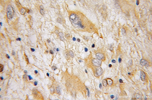 [11991-1-AP-20UL] Galc Polyclonal antibody