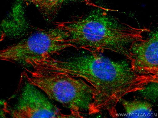 [11996-1-AP-150UL] MLK3 Polyclonal antibody