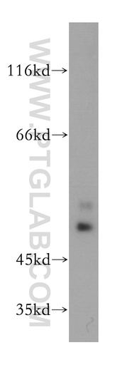 [11997-1-AP-20UL] OLFM2 Polyclonal antibody