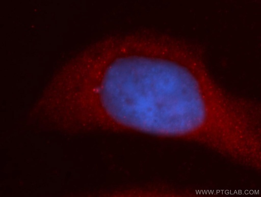[11998-1-AP-150UL] URG4 Polyclonal antibody