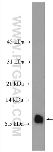 [12000-1-AP-150UL] RANTES Polyclonal antibody