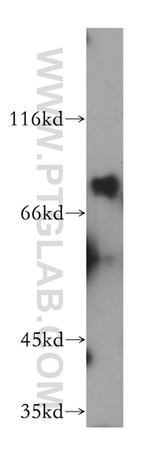 [12001-1-AP-20UL] Dymeclin Polyclonal antibody