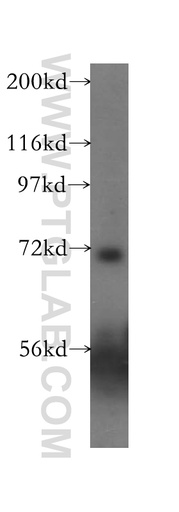 [12003-1-AP-150UL] ASIC4 Polyclonal antibody