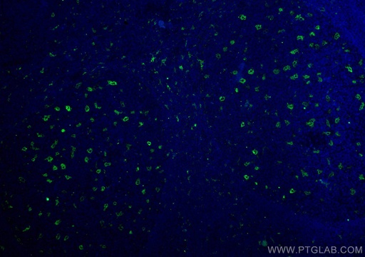 [12008-1-AP-150UL] TIMD4 Polyclonal antibody