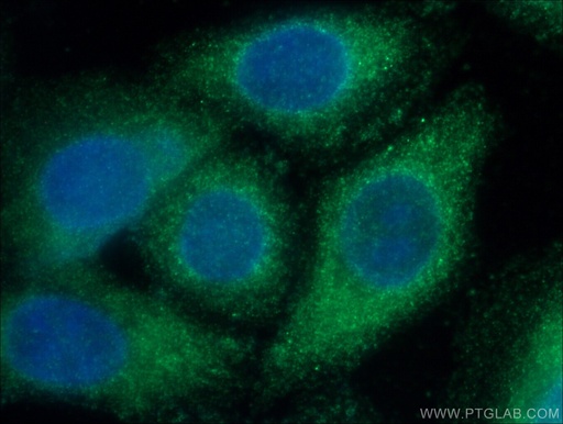 [12010-1-AP-150UL] SERPINA6 Polyclonal antibody