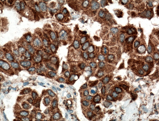 [12011-1-AP-20UL] SMYD3 Polyclonal antibody