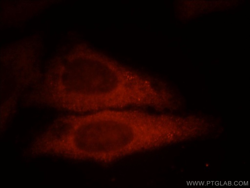 [12012-1-AP-20UL] UBE2G1 Polyclonal antibody