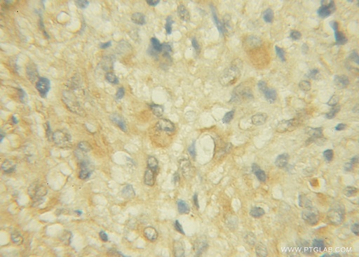 [12013-1-AP-150UL] CHST10 Polyclonal antibody
