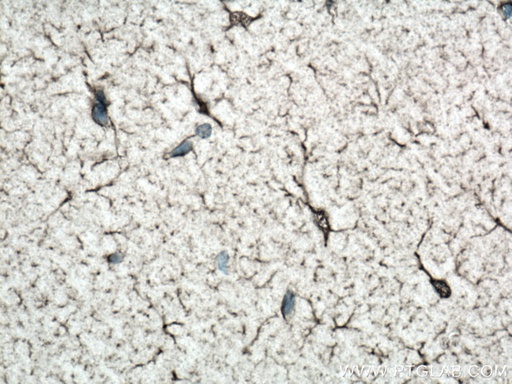 [12015-1-AP-20UL] NDRG2 Polyclonal antibody
